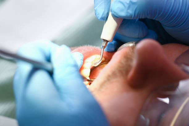Best Emergency Dental Services for Seniors in Troy, NC