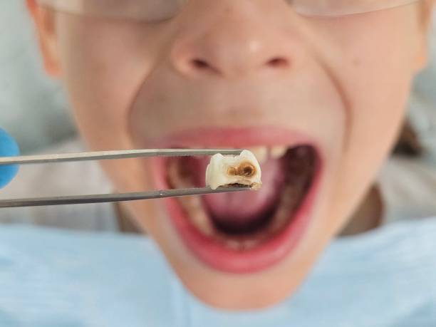 Best Emergency Dental Services for Seniors in Troy, NC